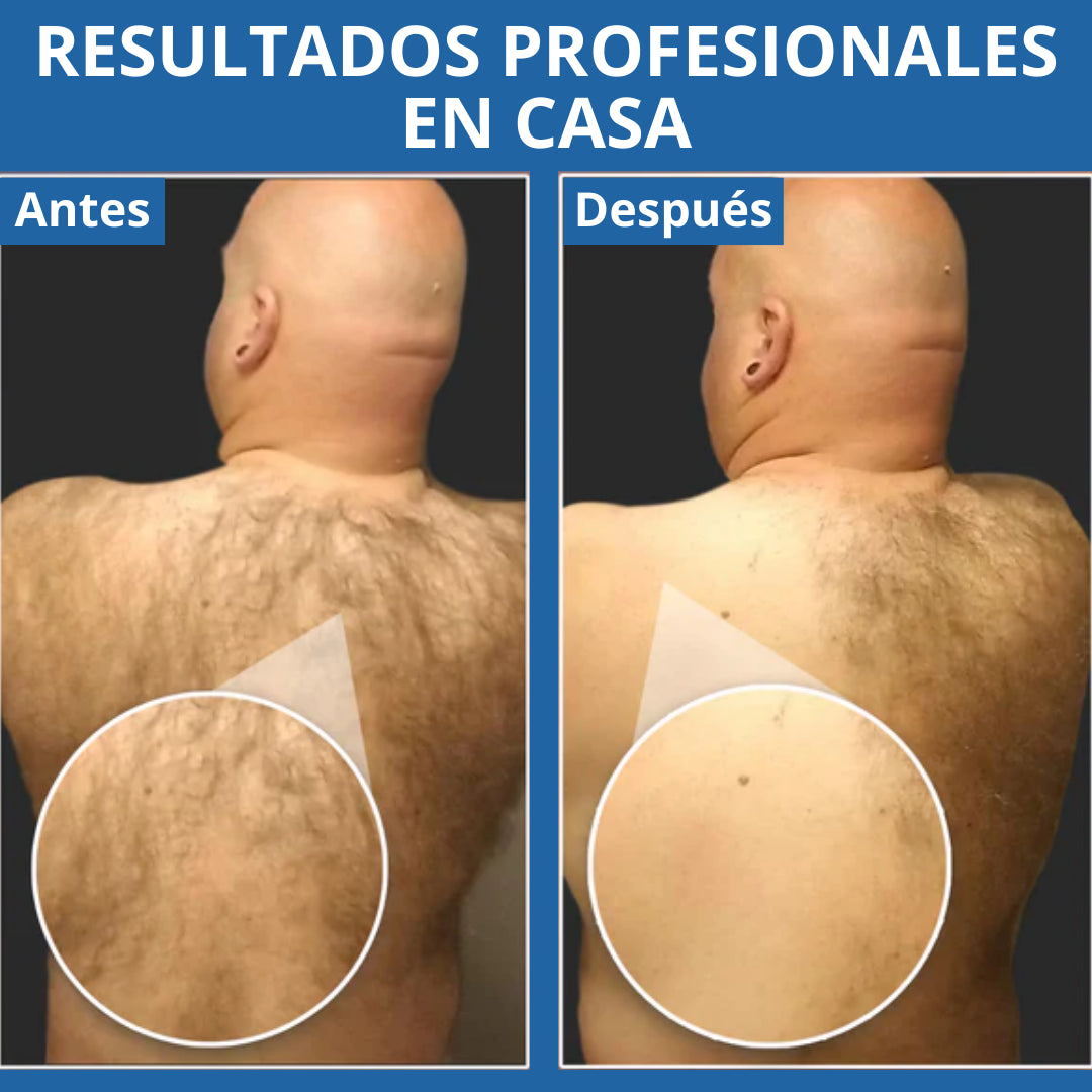 MAXBLADE®: Rasura tu espalda fácil y rápido