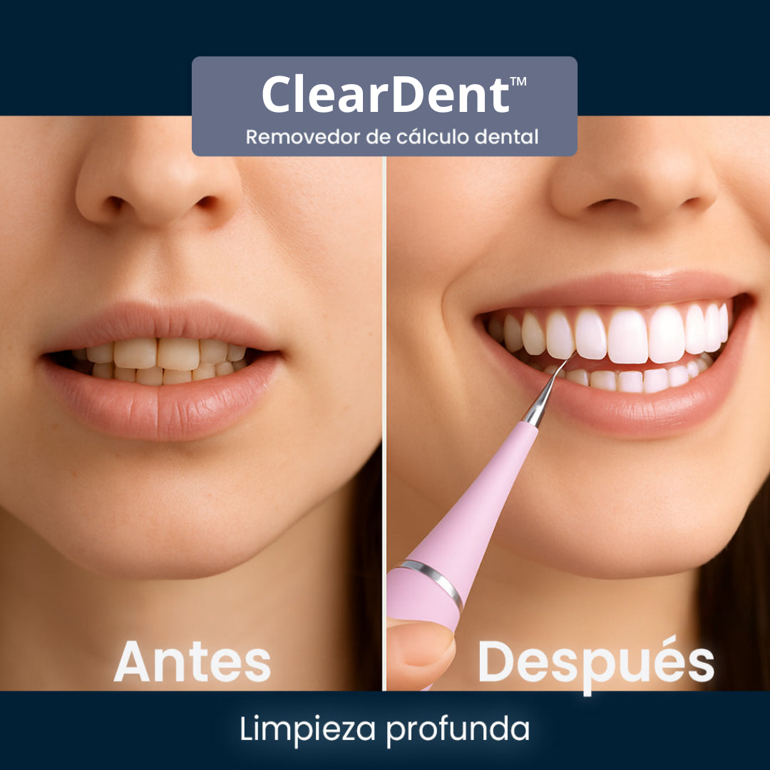 ClearDent™: Limpiador dental ultrasónico
