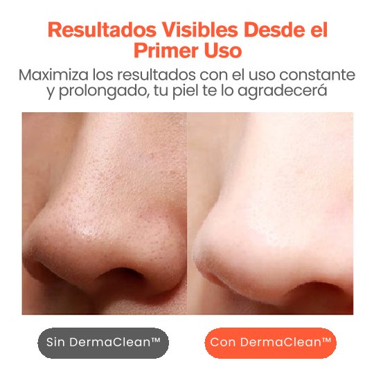 DermaClean™ La Espátula Ultrasónica que Revolucionará tu Rutina de Skincare